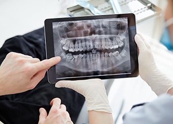 Gloved hand touching dental X-ray displayed on computer monitor