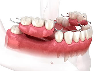 Smiling senior man in dental chair