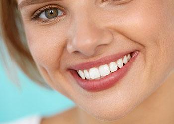 woman smiling after Icon treatment