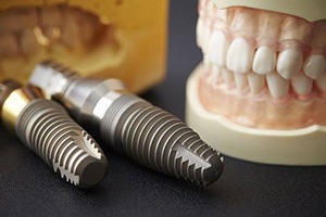 two dental implants lying next to a set of false teeth