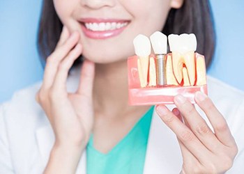 dentist holding a model of a dental implant in the jaw