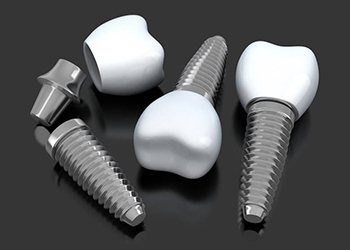three dental implant posts with abutments and crowns