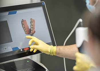 Gloved hand holding digital dental scanner